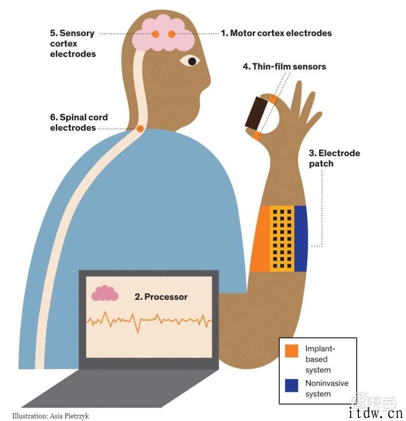 硬核：科学家打造出整套人工神经系统，让瘫痪病人再次操纵身体