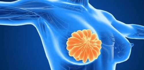 乳房癌症的十大早期信号
