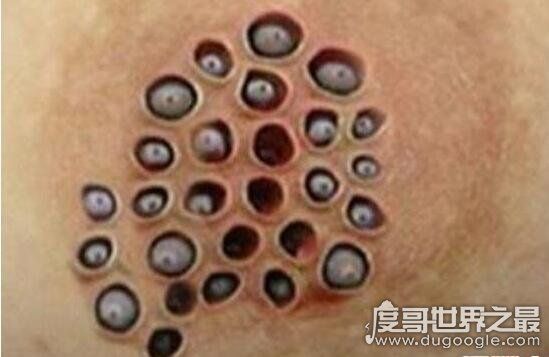 空手指莲蓬乳可以说是目前流传与网络上最为恶心的图片之一了