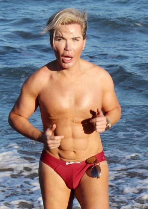 Rodrigo Alves10年间花280万做42次整容手术