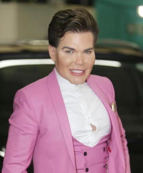 Rodrigo Alves10年间花280万做42次整容手术