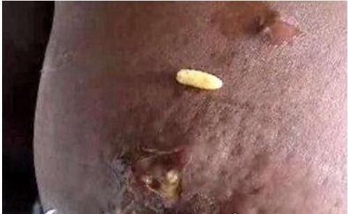 空手指莲蓬乳可以说是目前流传与网络上最为恶心的图片之一了