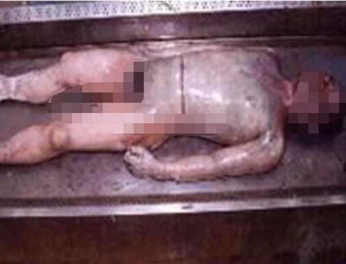 人死后尸体如果没有得到妥善的处理救会形成腐烂