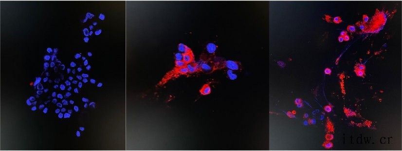 香港大学成功研发高铜含量不锈钢材,3小时可杀灭 99