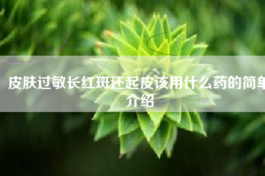 皮肤过敏长红斑还起皮该用什么药的简单介绍