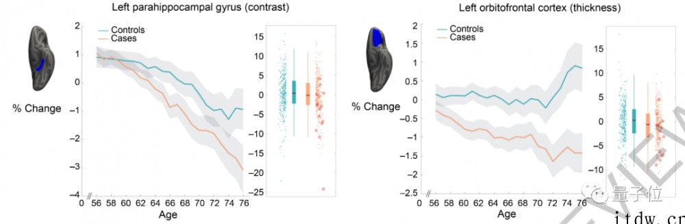 新冠轻症也会导致大脑退化,牛津大学最新研究登上 Nature