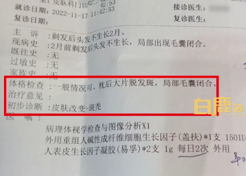 宝宝剃胎毛后局部毛囊闭合难