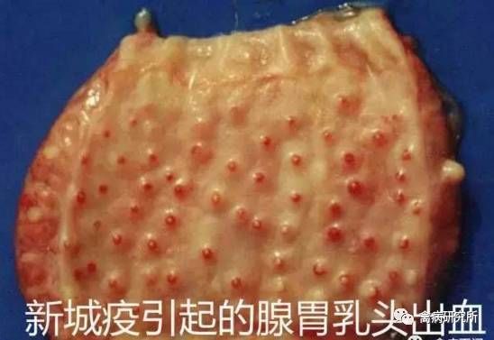 扁桃体切除吐出黄色组织(切除扁桃体后白膜脱落疼吗)