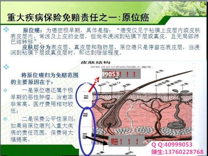 原位癌是什么意思(原位癌手术后能活几年)