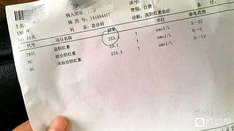 在哪测黄疸(自己在家怎么测黄疸)