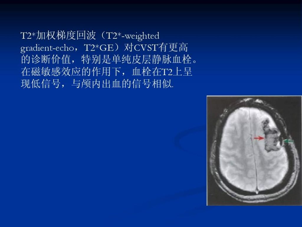 脉窦在哪里(颈动脉窦在哪里)