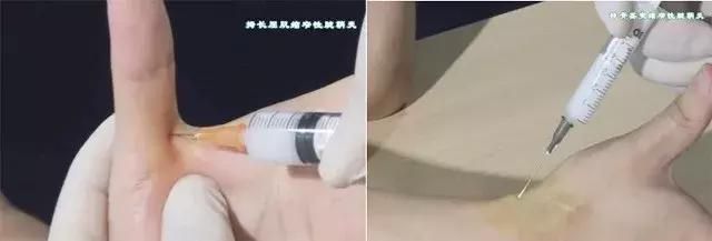 打封闭什么意思(nba打封闭什么意思)