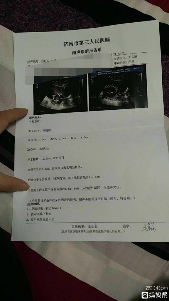 宫颈管1.3cm早产概率的简单介绍