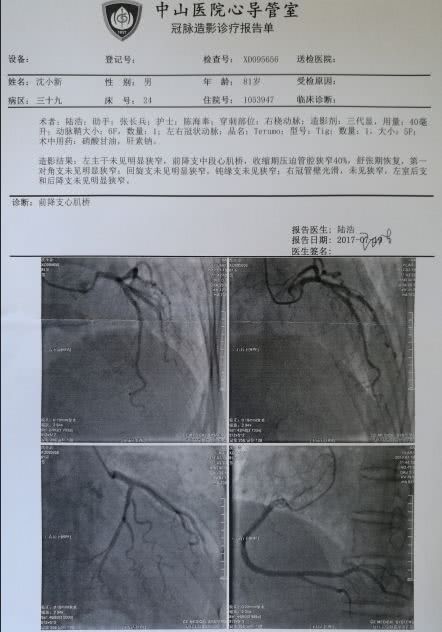 纯缘支在哪(纯缘支是什么东西)