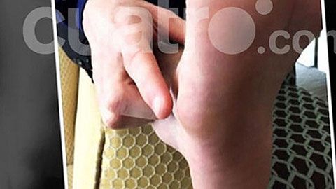 脚肿视频大全的简单介绍