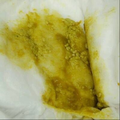 宝宝一直都是拉肚子(八个月宝宝一直拉肚子怎么办)