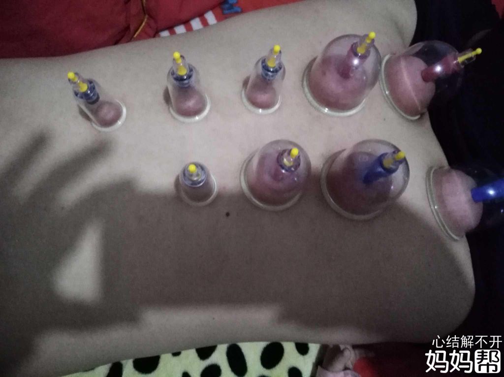 拔罐能让肉包多吗的简单介绍