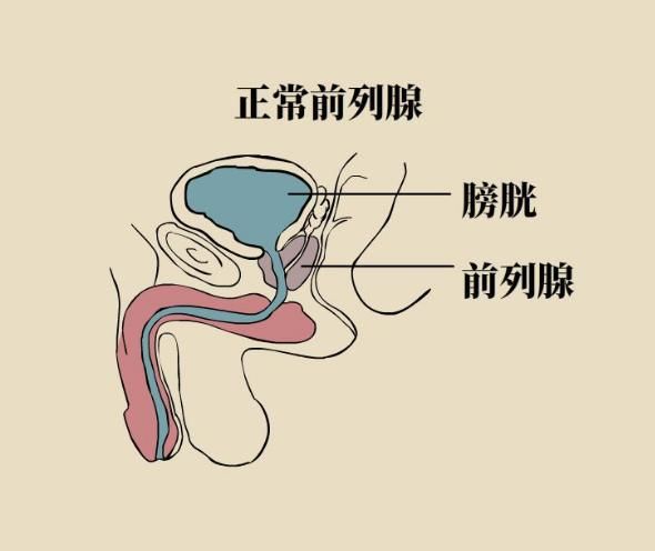 前列腺位置在哪个部位(前列腺位置在哪个部位实物图片)