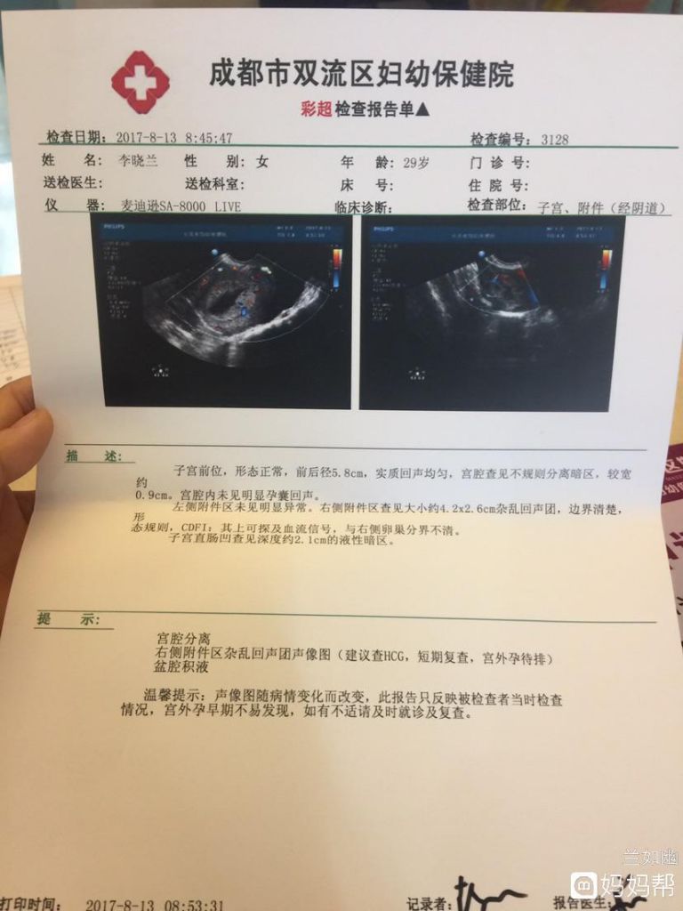 右边输卵管宫外孕的话哪边会疼的简单介绍