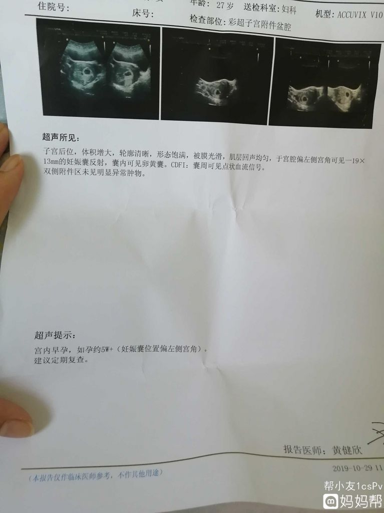 怀孕在哪个位置(刚怀孕孩子在哪个位置)