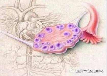 有多囊卵巢综合症怎么办呀的简单介绍