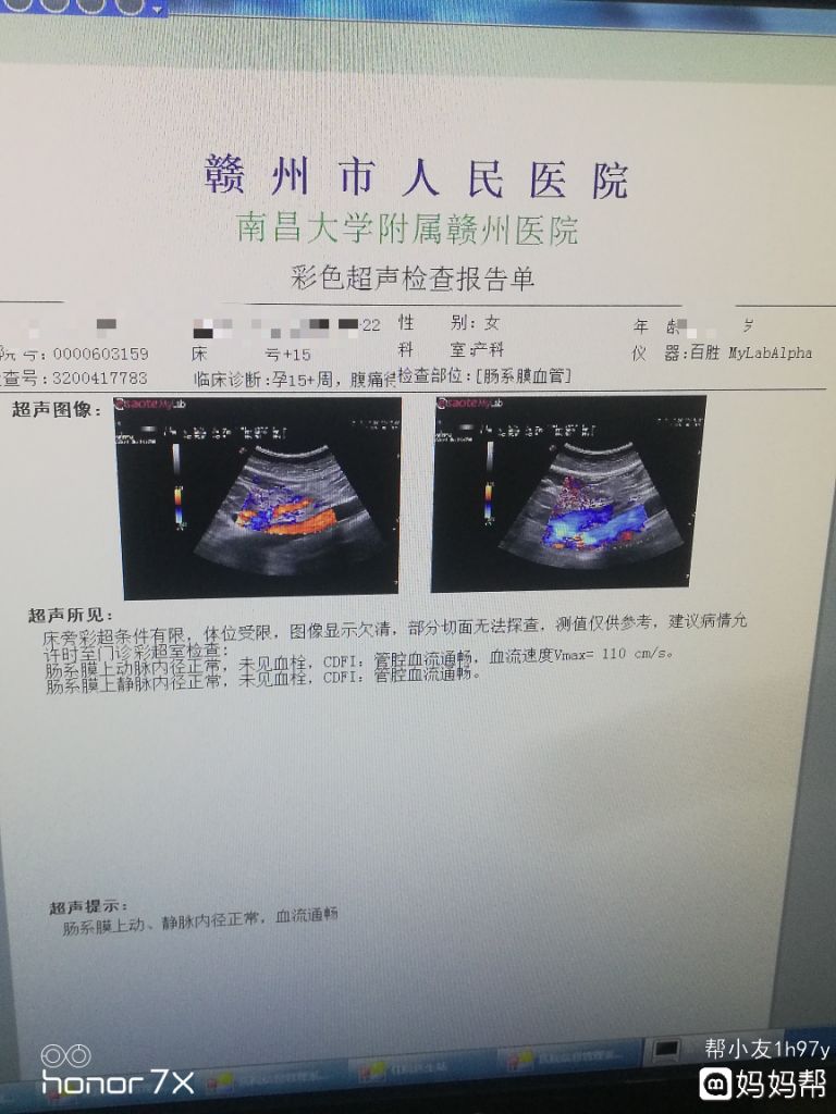 腹是在哪里(增强防御的永歌符石在哪里)