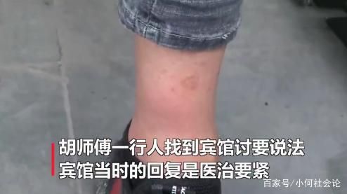 被大蜈蚣咬了没感觉的简单介绍