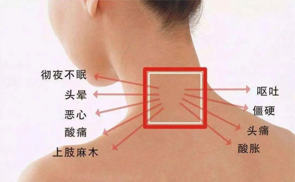 脖子大动脉在哪里(脖子大动脉堵塞怎么办)