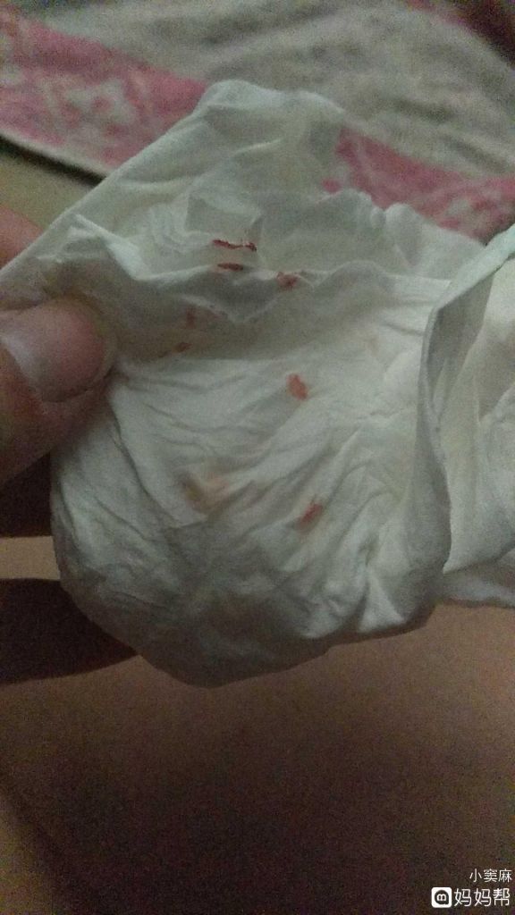 还没来大姨妈流血是怎么回事的简单介绍