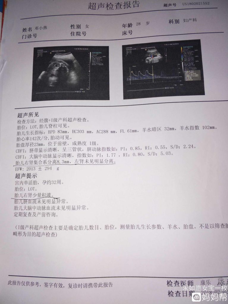 双肾少量积水什么原因(双肾少量积水是什么原因导致的)