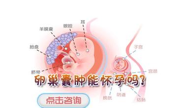 卵巢囊肿长在哪里(卵巢囊肿扭转在哪里痛)