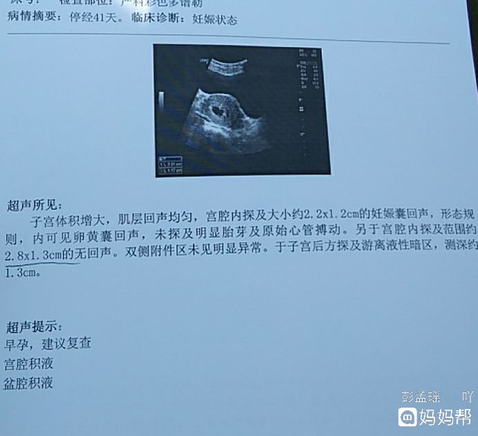 盆腔积液在哪个位置(盆腔积液多大需要治疗)