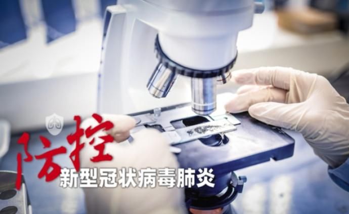 北京病毒在哪(北京新冠病毒最新情况)