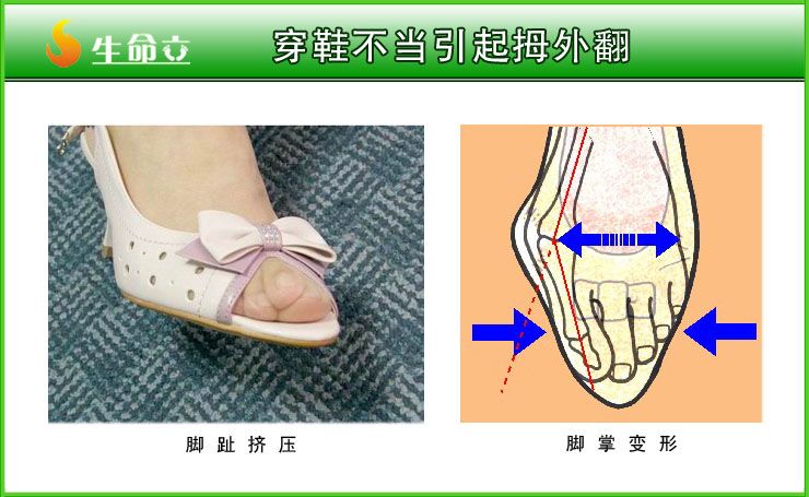 包含大拇指外翻做什么动作的词条 包含大拇指外翻做什么动作的词条