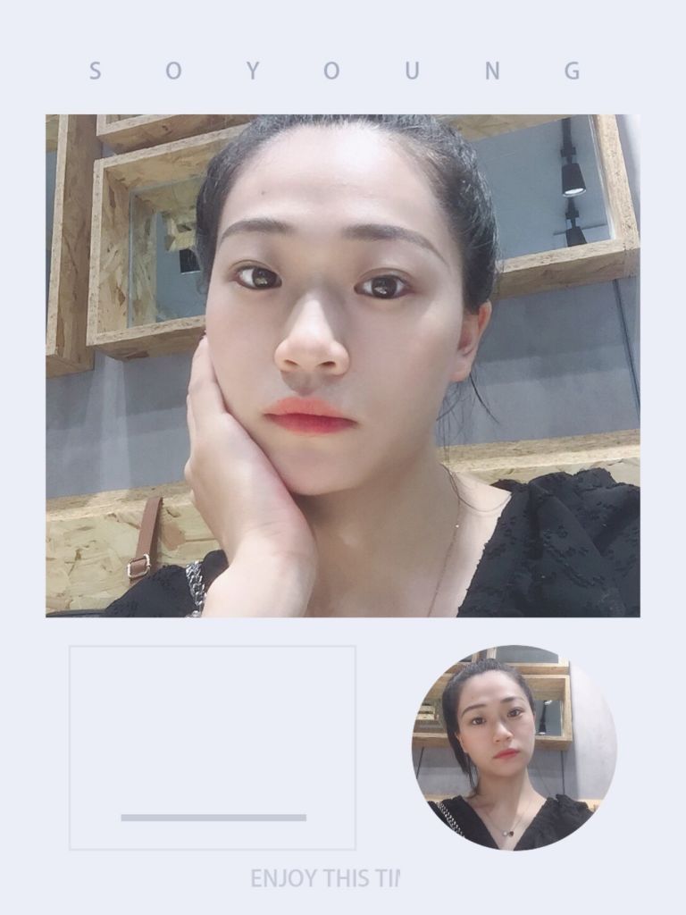 关于除皱针打完几天有紧绷感的信息