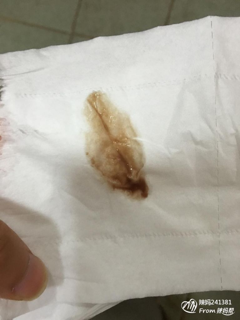 14岁月经咖啡色(月经量少且呈棕褐色)
