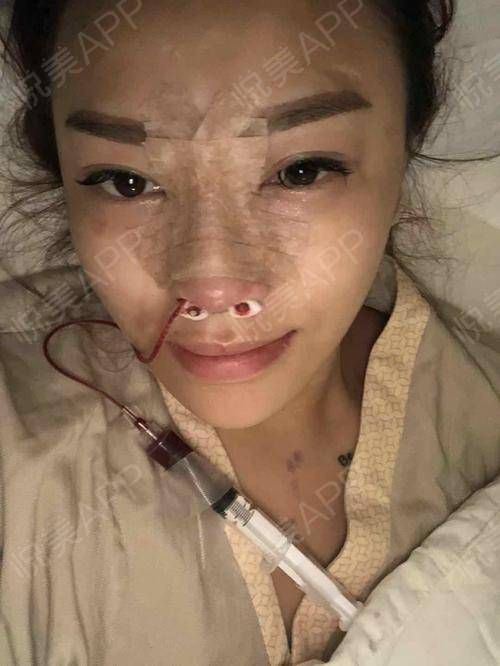 在哪整形好(鼻部整形哪好)