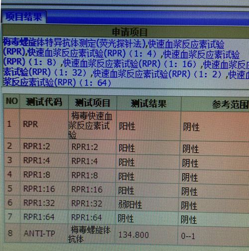 梅毒螺旋体抗体检测化验单(非梅毒螺旋体抗体检测可采用的方法)