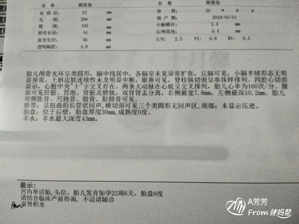 双肾轻微积水属于严重吗(双肾轻微积水和什么有关系)