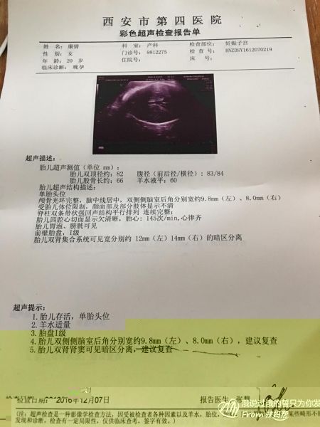 双肾轻微积水属于严重吗(双肾轻微积水和什么有关系)