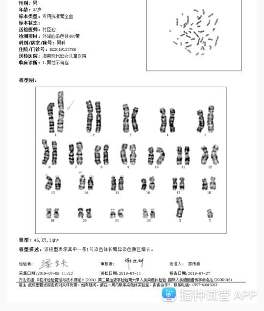 怎样查男子染色体(怎样查精子内有没有y染色体)