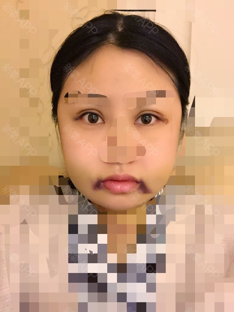 别开外眼角(你别眼角四年级)