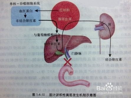 总胆固醇高是什么情况造成的(总胆固醇高是什么原因怎么治疗)