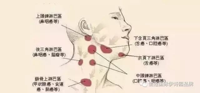 腋下淋巴结在哪(腋下淋巴结在哪里)