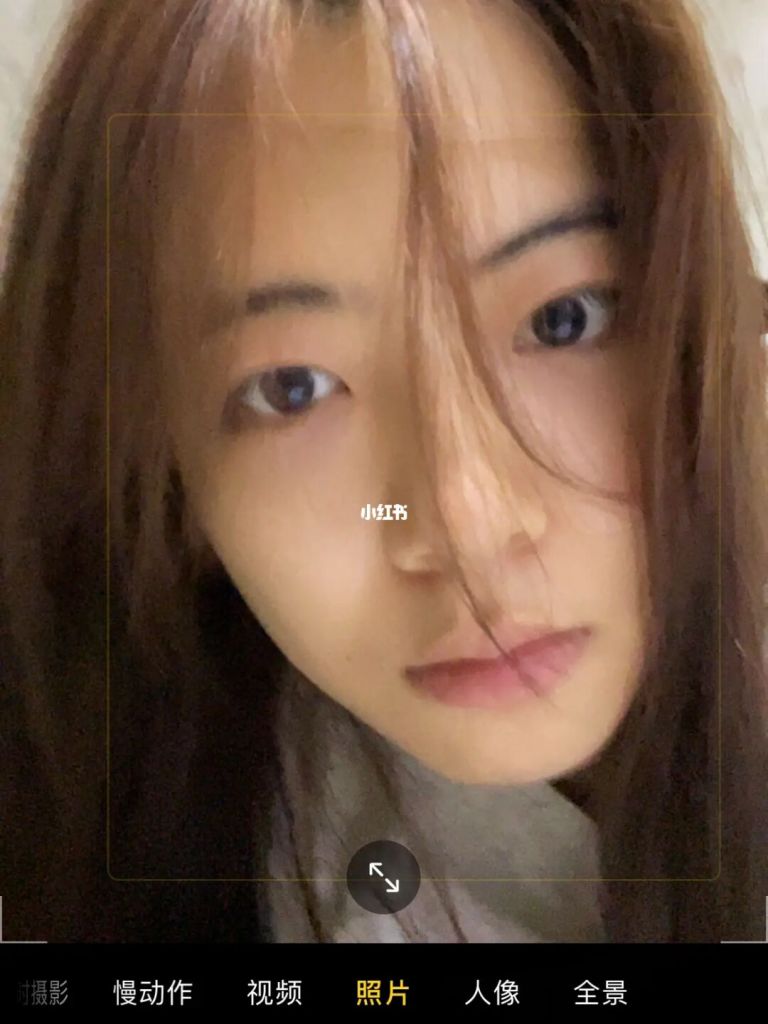 包含荨麻疹眼部长是不是很严重的词条