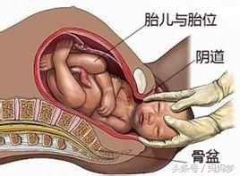 孕晚期宝宝双顶98能顺产吗的简单介绍