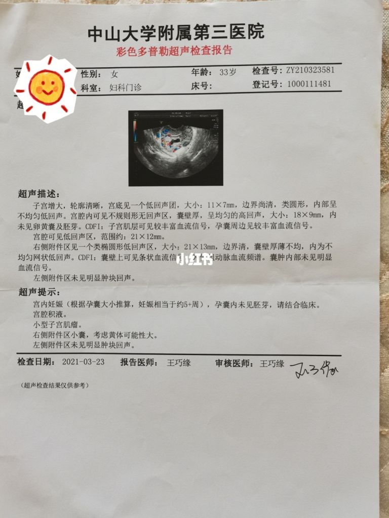 没有胎心导致胎停(什么情况导致胎心停)