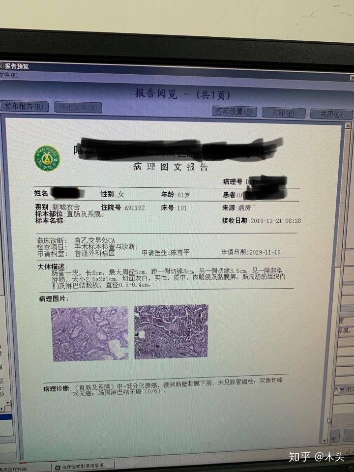 结肠癌的化疗单吃药可以吗(结肠癌术后化疗吃药好还是打针效果好)