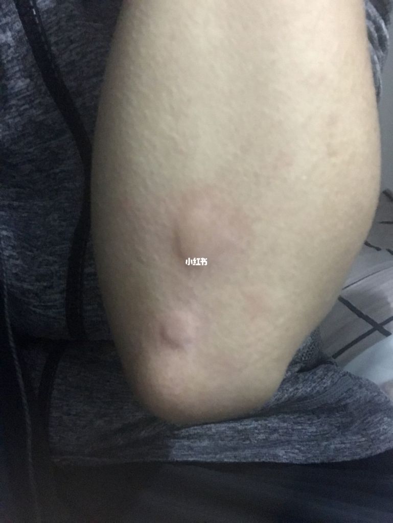 关于旮瘩在哪的信息