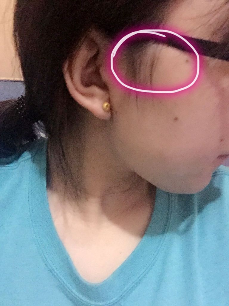 耳朵里面被弄破了特别疼怎么办的简单介绍